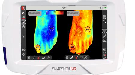 Dispositif de diagnostic portable "Snapshot NIR" pour remplacer l'échographie et la radiographie