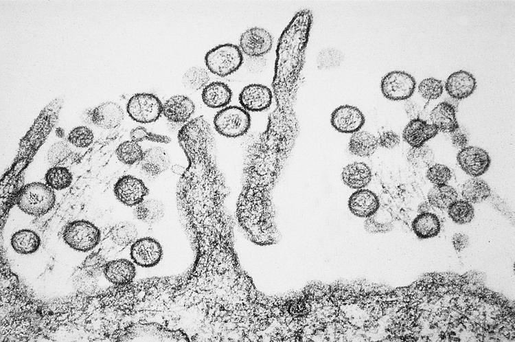 Un laboratoire australien manque des virus ...