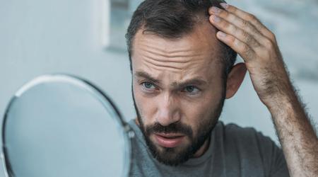 Des scientifiques ont découvert une propriété inattendue du sucre de l'ADN qui pourrait résoudre le problème de la perte de cheveux chez les hommes et les femmes.