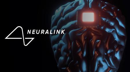 Élargissement du programme Neuralink : des volontaires du monde entier peuvent désormais se porter candidats à l'implantation de la neuropuce innovante.