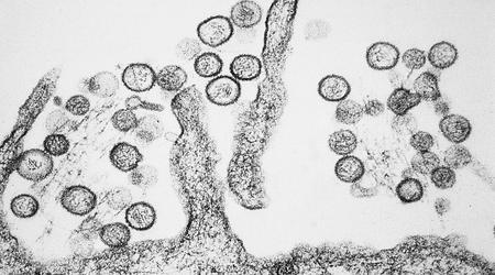Un laboratoire australien manque des virus dangereux en raison d'une défaillance du congélateur