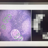 Google et le Pentagone ont mis au point un microscope basé sur l'intelligence artificielle pour le diagnostic du cancer-6 Google et le Pentagone ont mis au point un microscope basé sur l'intelligence artificielle pour le diagnostic du cancer-6
