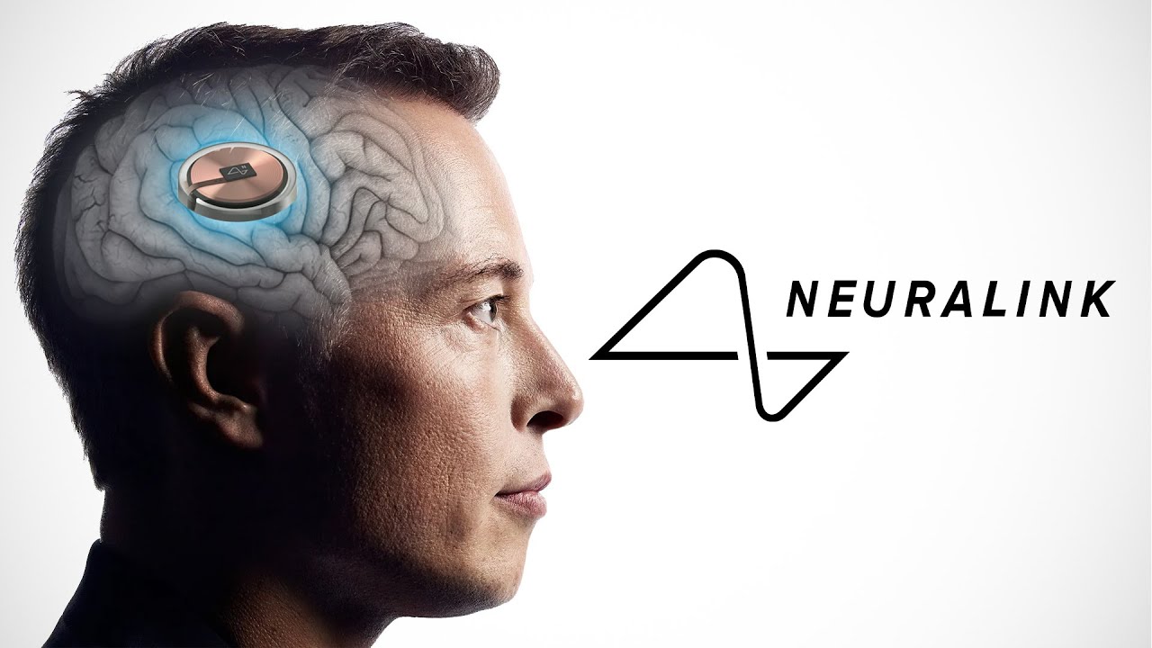 Aucun singe n'est mort - Musk affirme que les implants cérébraux Neuralink sont sûrs Aucun singe n'est mort - Musk affirme que les implants cérébraux Neuralink sont sûrs