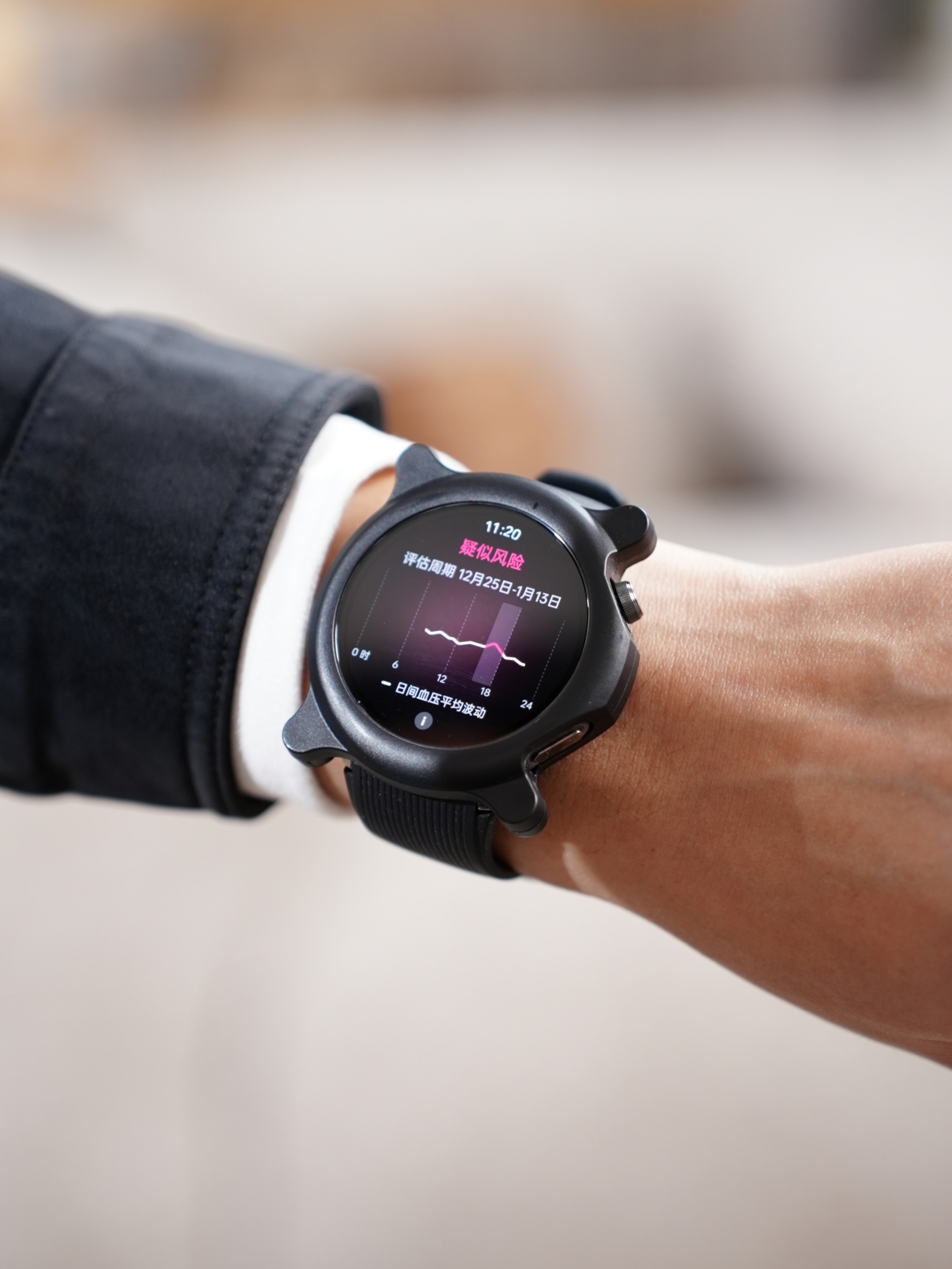La nouvelle Oppo Watch X2 dans un étui de protection