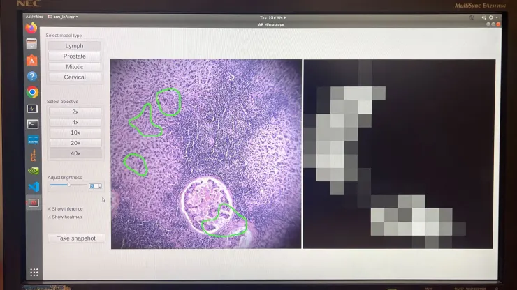 Google et le Pentagone ont mis au point un microscope basé sur l'intelligence artificielle pour le diagnostic du cancer-3 Google et le Pentagone ont mis au point un microscope basé sur l'intelligence artificielle pour le diagnostic du cancer-3